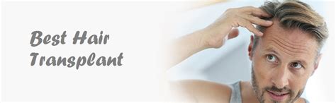 best mens hair restoration st louis|RESTORE Hair .